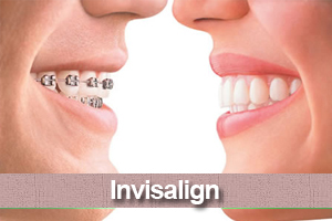 SPA-DENTAL
